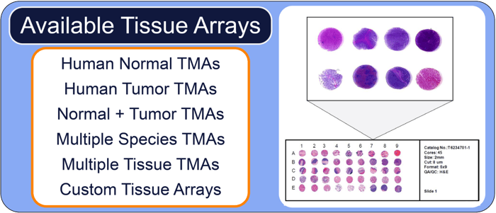 Products - Frozen Array-RS-1